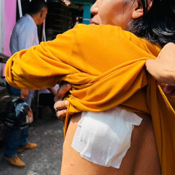 Monyet Abu-abu Raksasa Teror Warga Tembilahan, 10 Orang Jadi Korban Keganasan