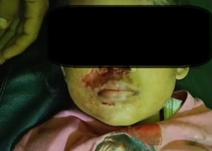 Bocah SD di Pekanbaru Diserang Gajah Liar, Warga Panik Saat Rumah Dikepung Satwa