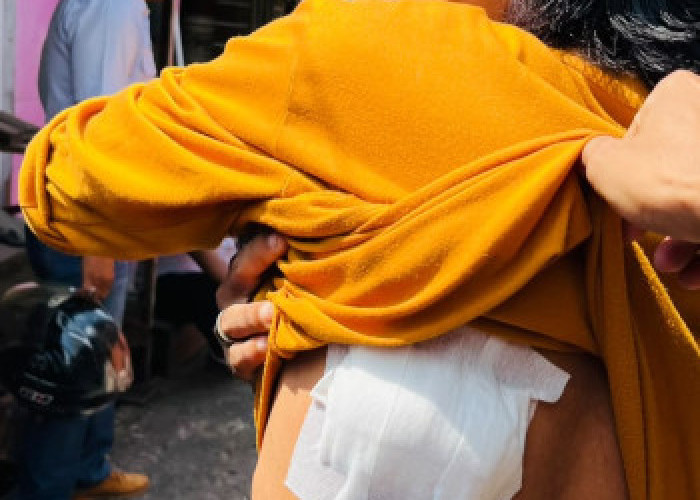 Monyet Abu-abu Raksasa Teror Warga Tembilahan, 10 Orang Jadi Korban Keganasan