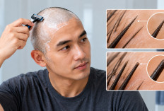Apa Benar Mencukur Habis Rambut Membuatnya Tumbuh Lebih Tebal? Ini Penjelasan Ilmiahnya